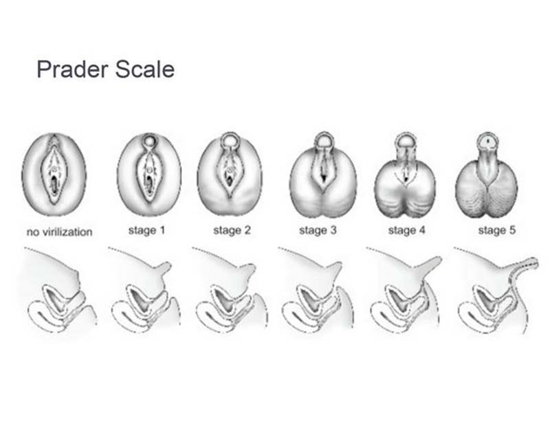 Clitoris Scale