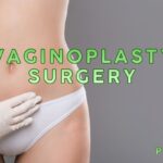 cosmetic vaginoplasty